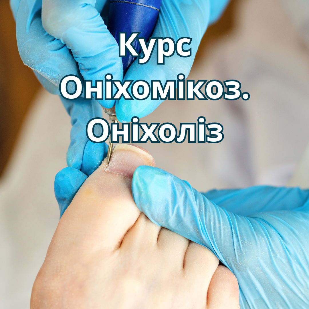Курс "Оніхомікоз та Оніхоліз"